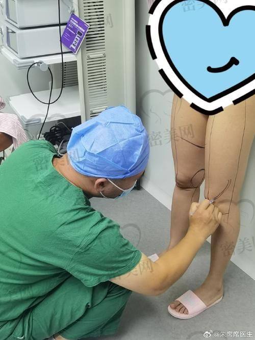 北京米兰柏羽丽都整形医院高海燕：真人实例见证奇迹