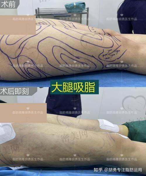 北京米兰柏羽丽都整形医院高海燕：实力医生的魅力
