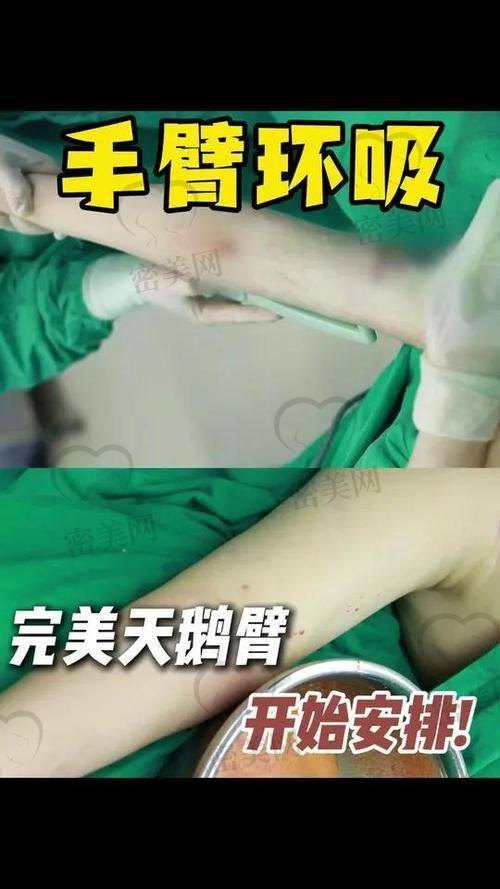 探秘北京米兰柏羽丽都整形医院高海燕医生的魅力