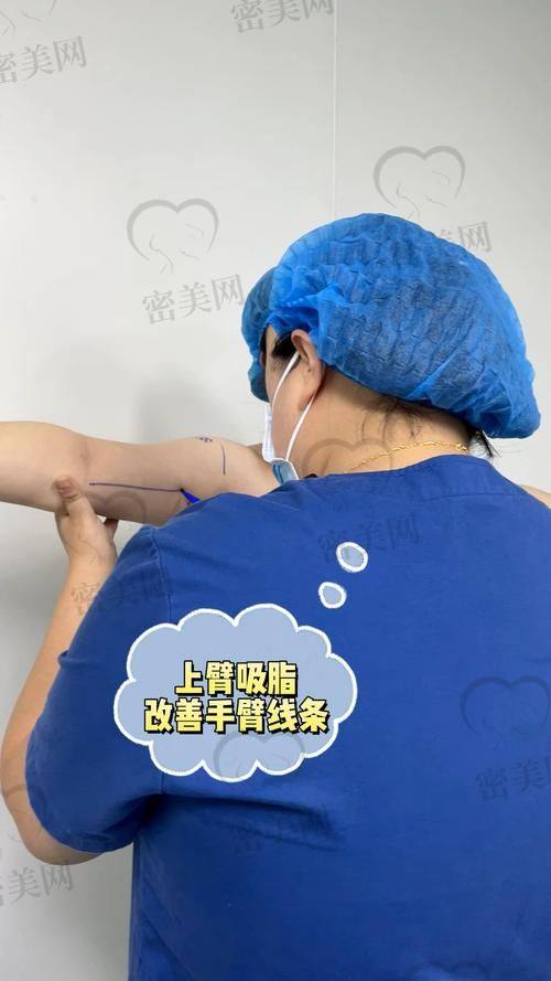 北京米兰柏羽丽都整形医院高海燕小部位吸脂：口碑爆棚