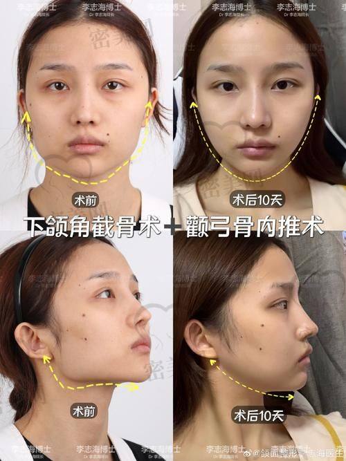 北京华韩吴国平：超厉害的医生来啦