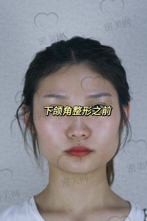 北京华韩：超棒的整形医院等你来
