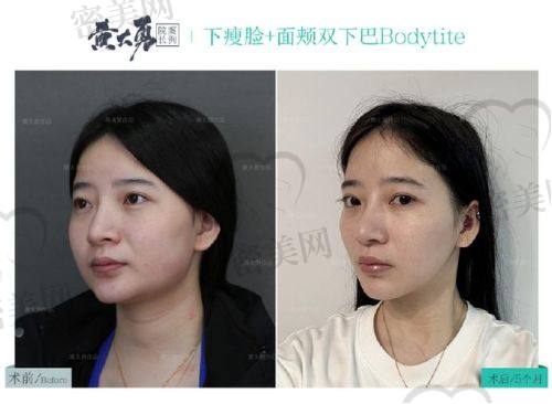 北京华韩吴国平：口碑爆棚的秘密