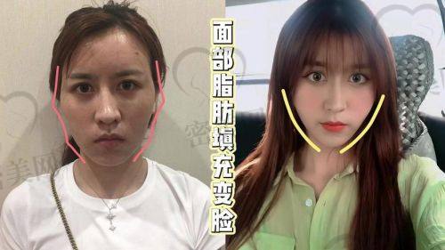 价格大揭秘，不同方案不同价