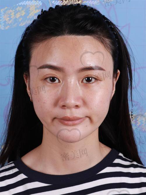 修复成效，惊艳到自己