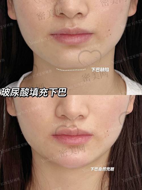 手术过程：紧张又期待
