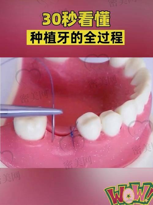 患者口碑评价真实不做作，种出“真牙级”的体验