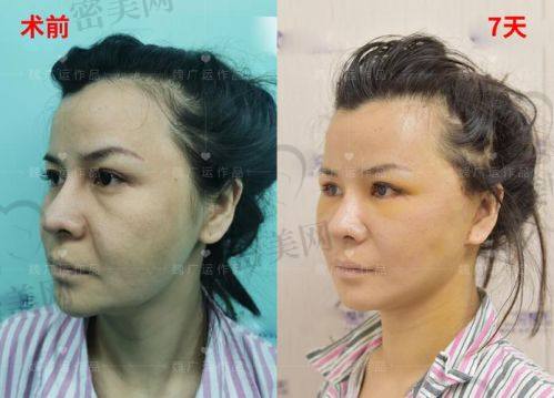 加减美穆宝安专精能力有多强？