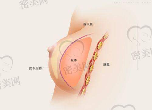 吴蓉医生擅长项目：