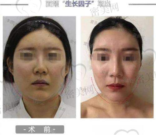 修复饮食怎么吃？