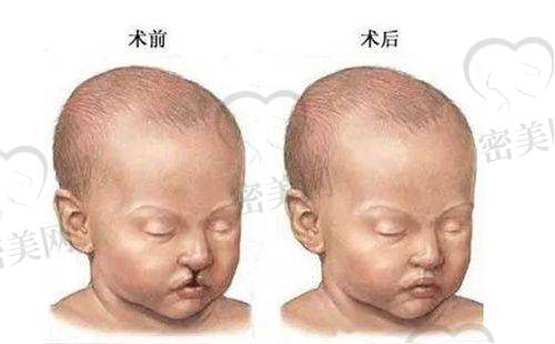 徐伟成医生荣誉资质：