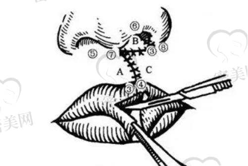 张占召医生怎么预约挂号？