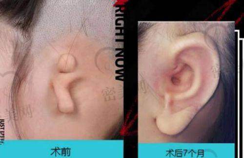 祁强医生技术特点：