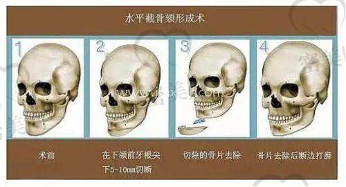 任晓丽医生技术特点：
