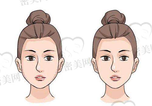 王婷婷医生口碑怎么样？