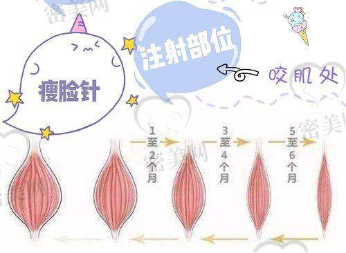 张志宇医生技术特点：