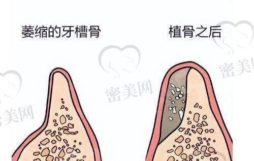 吴蓉医生口碑怎么样？