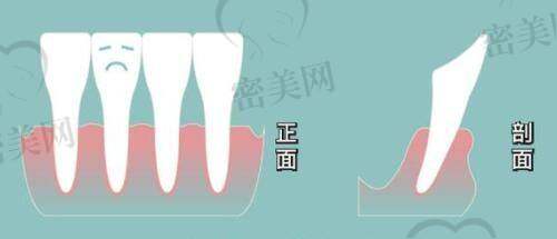 李恒医生擅长项目：