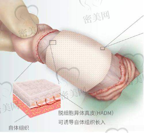 张亮医生口碑怎么样？