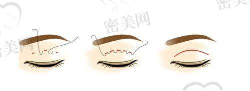 赵亮医生口碑怎么样？
