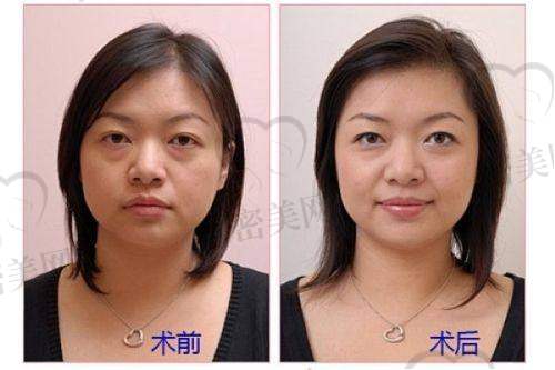 童列健医生怎么预约挂号？