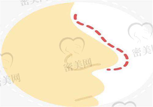 尹飞医生怎么预约挂号？