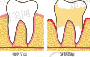 上海仇兰英口腔诊所擅长什么项目：
