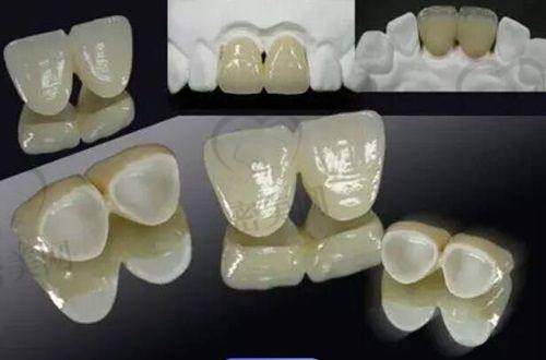 珠海暨博口腔医院：矫正/种植双强科室，贴面美学见长