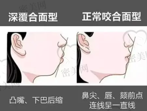 上海葛氏口腔门诊部口碑怎么样？