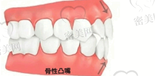 珠海拜博口腔：儿童看牙+老人种牙都靠谱