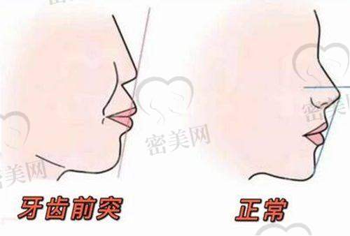 任丘中源口腔医院医生团队经验多，擅长种植和正畸