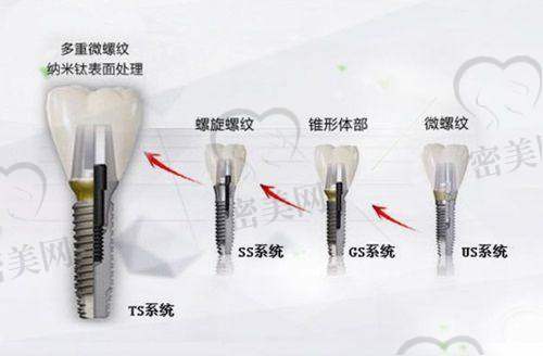 柳州蓝天口腔门诊部看牙体验流程顺，线上预约更便捷