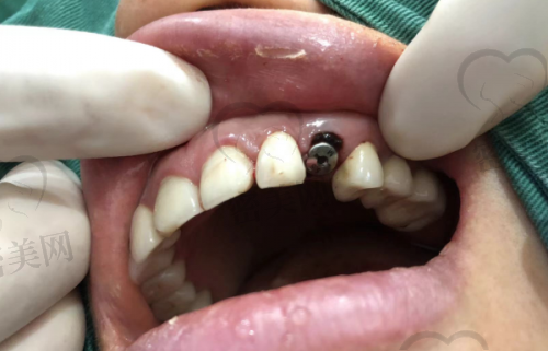 上海黄怡口腔诊所是正规的吗？