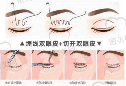 朴洪权医生怎么预约挂号？
