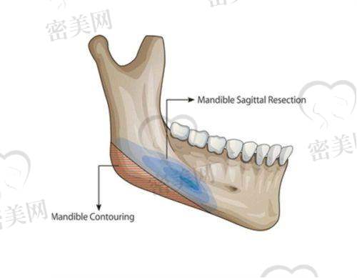 任晓丽医生擅长项目：