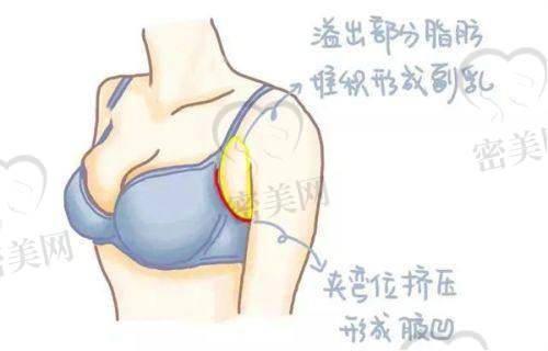 李恒医生口碑怎么样？
