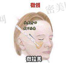 张金辉医生技术特点：