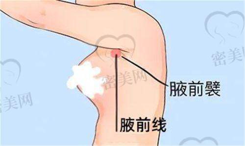 徐伟成医生擅长项目：
