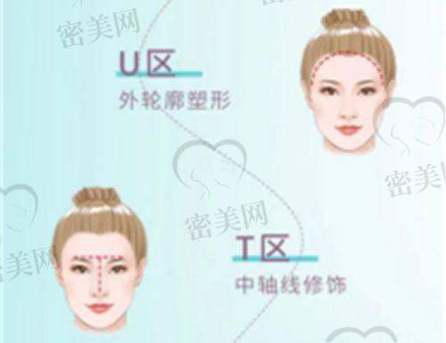 吴蓉医生怎么预约挂号？