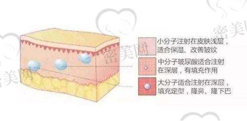 整下巴好不好？有啥潜在危害？