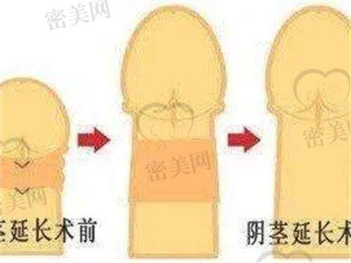 黄益凡医生口碑怎么样？