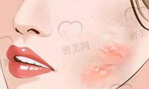 邵斌医生怎么预约挂号？