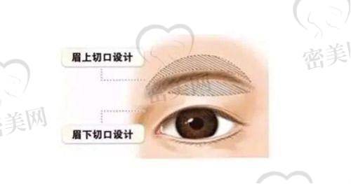 邵斌医生擅长项目：