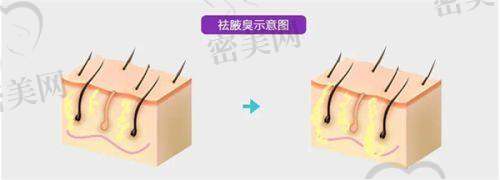 李智明医生口碑怎么样？