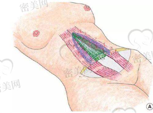 陈亚明医生怎么预约挂号？