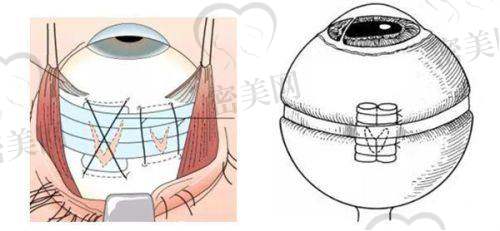 收费项目合理透明，不存在隐性消费