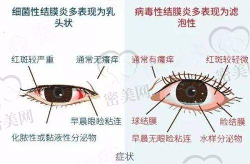 南宁爱尔眼科五大分院服务亮点横向对比