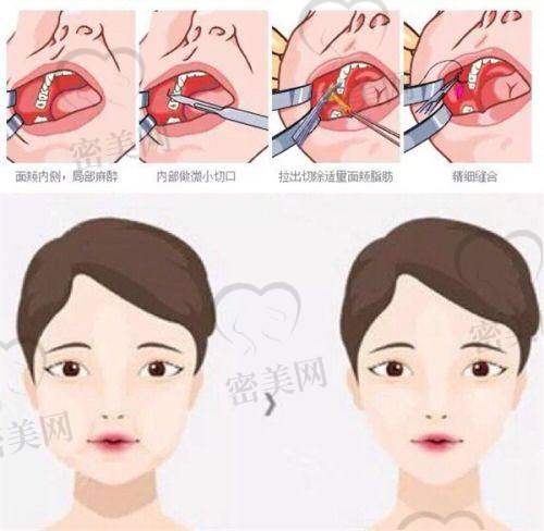 张占召医生擅长项目：