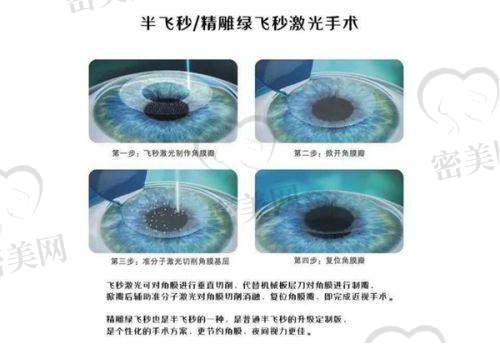 医生经验多，手术量高，术后成效更稳