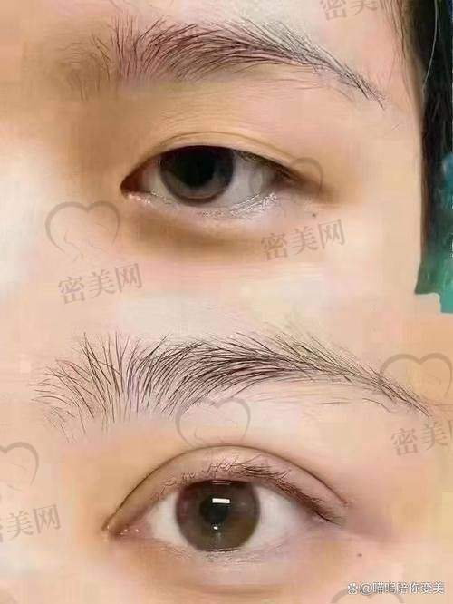 谢立宁医生：6800 元背后的不错技术魔法
